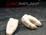 BioImplant – The Anatomic Non-Surgical Dental Implant Solution