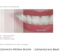 Zahnarzt Basel Zahnpraxis Zahnärzte ein Lachen überzeugt - Dr. Rutschmann