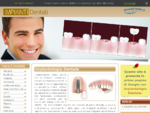 Implantologia → Impianti Dentali